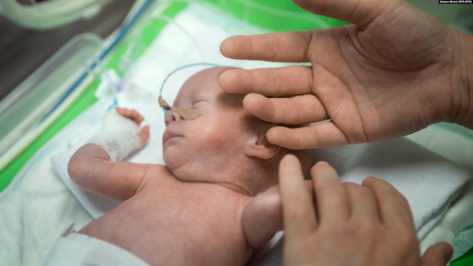 Фото до новини «Всесвітній день передчасно народжених дітей 17 листопада.»